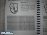 Elektrokadiografia dla lekarza - Obrazek 2